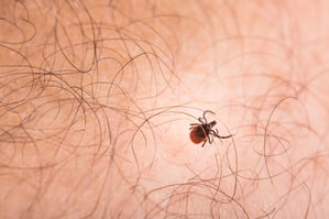engorged-tick-crawling-on-skin-with-hair-follicles-2026-03-05-11-32-52-utc