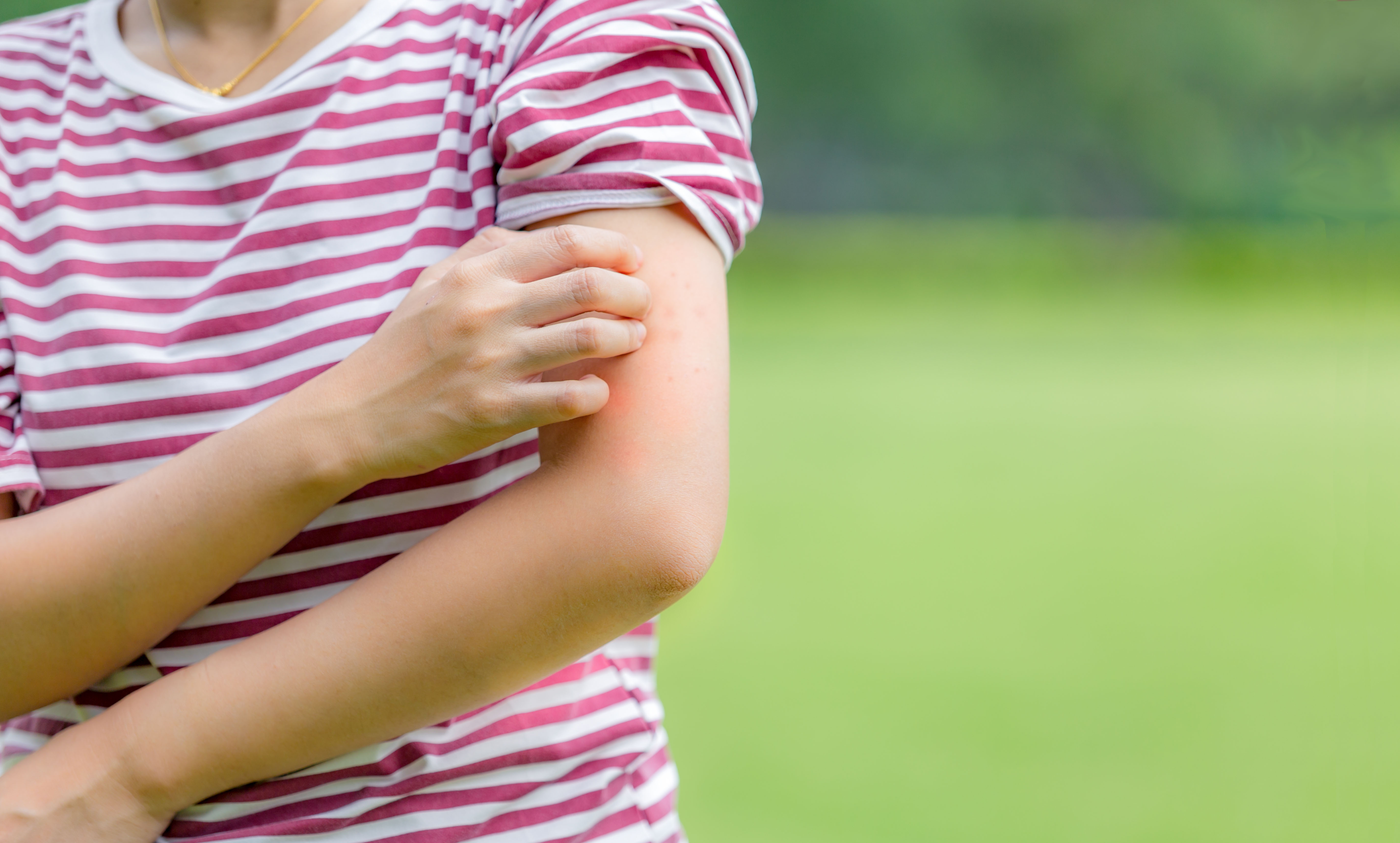 4 Ways To Prevent Mosquito Bites!